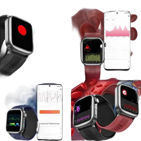 2025 Montre intelligente ECG santé avec diagnostic de pression artérielle précise